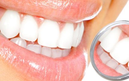 Diş Beyazlatma İşlemi Dişe Zarar Verir mi?